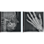 Vistapano S 2D Ceph Vistapano S 2D Ceph